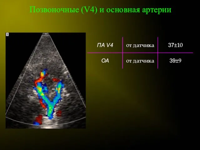 Позвоночные (V4) и основная артерии