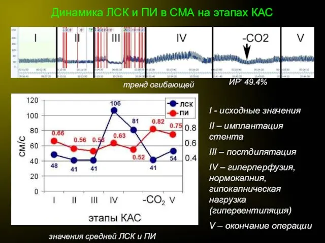 Динамика ЛСК и ПИ в СМА на этапах КАС тренд огибающей