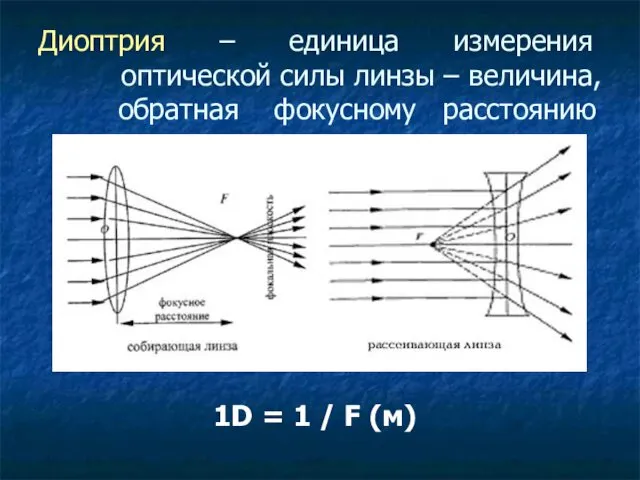 Диоптрия – единица измерения оптической силы линзы – величина, обратная фокусному