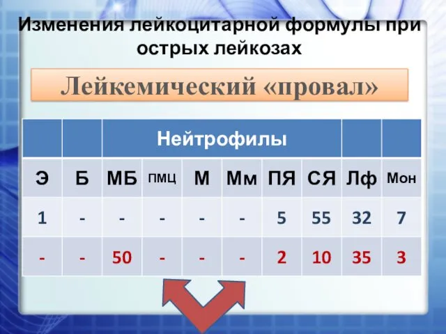 Изменения лейкоцитарной формулы при острых лейкозах Лейкемический «провал»