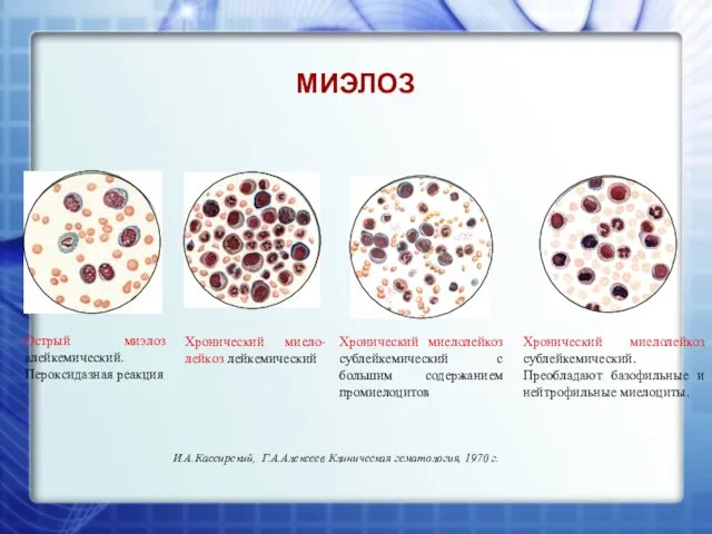 МИЭЛОЗ И.А.Кассирский, Г.А.Алексеев Клиническая гематология, 1970 г.