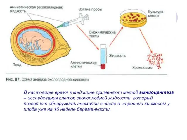 В настоящее время в медицине применяют метод амниоцентеза – исследования клеток