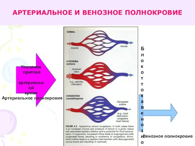 АРТЕРИАЛЬНОЕ И ВЕНОЗНОЕ ПОЛНОКРОВИЕ Усиление притока артериальной крови Блок оттока венозной крови Артериальное полнокровие Венозное полнокровие