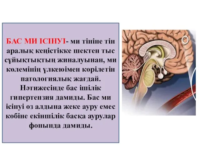 БАС МИ ІСІНУІ- ми тініне тін аралық кеңістікке шектен тыс сұйықтықтың