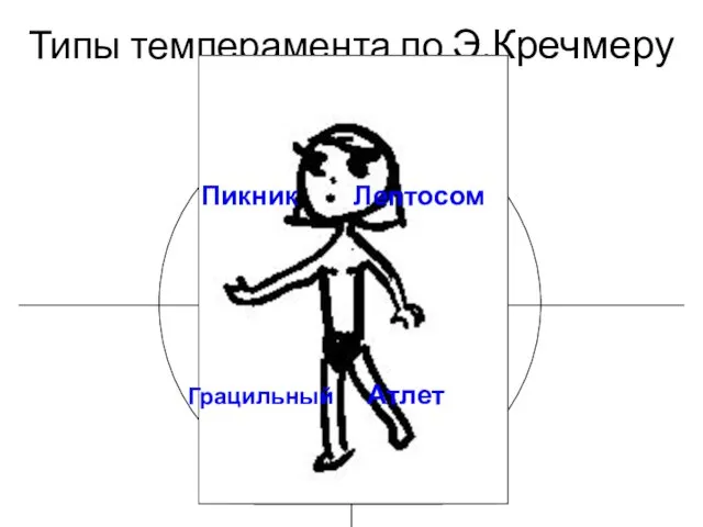 Типы темперамента по Э.Кречмеру Циклоид Циркулярный психоз МДП Шизофрения Эпилепсия Истерия