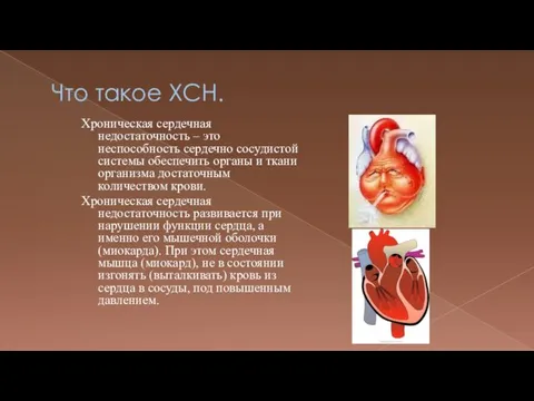 Что такое ХСН. Хроническая сердечная недостаточность – это неспособность сердечно сосудистой