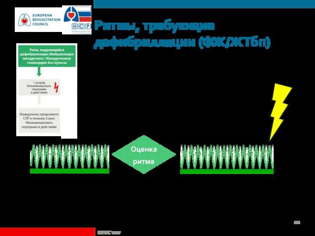 Ритмы, требующие дефибрилляции (ФЖ/ЖТбп) ©ERC vzw Оценка ритма