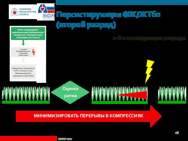 Персистирующая ФЖ/ЖТбп (второй разряд) 2-й и последующие разряды 150 Дж –