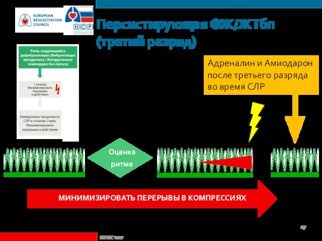 Персистирующая ФЖ/ЖТбп (третий разряд) Адреналин и Амиодарон после третьего разряда во