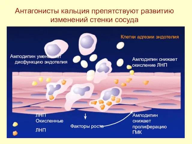 Антагонисты кальция препятствуют развитию изменений стенки сосуда ЛНП Окисленные ЛНП Клетки