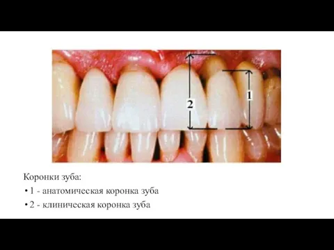 Коронки зуба: 1 - анатомическая коронка зуба 2 - клиническая коронка зуба