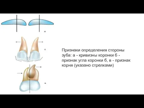 Признаки определения стороны зуба: а - кривизны коронки б - признак