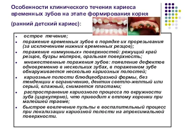 Особенности клинического течения кариеса временных зубов на этапе формирования корня (ранний