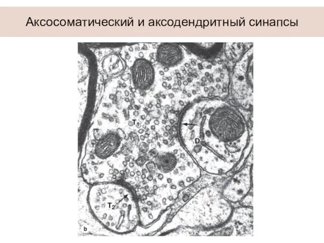 Аксосоматический и аксодендритный синапсы