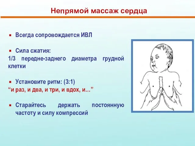 Непрямой массаж сердца Всегда сопровождается ИВЛ Сила сжатия: 1/3 передне-заднего диаметра