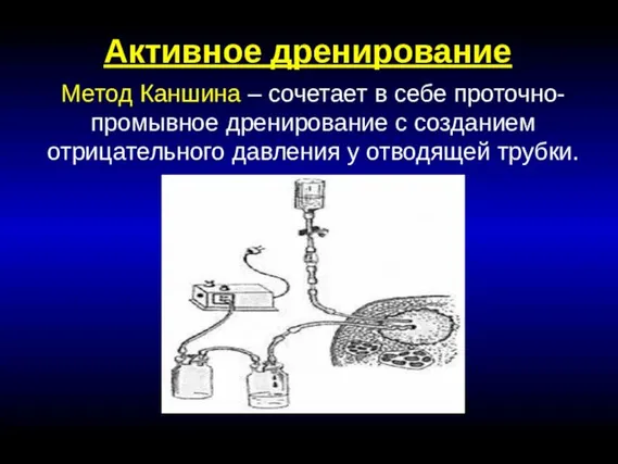 Активное дренирование Метод Каншина – сочетает в себе проточно-промывное дренирование с