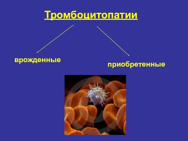 Тромбоцитопатии врожденные приобретенные