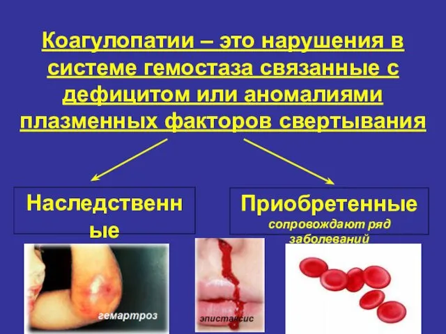 Коагулопатии – это нарушения в системе гемостаза связанные с дефицитом или