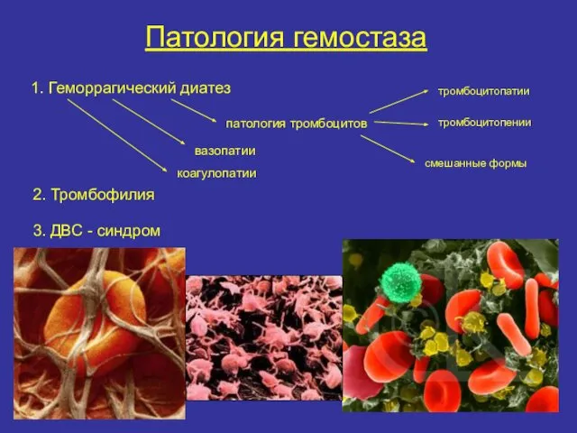 Патология гемостаза 1. Геморрагический диатез патология тромбоцитов тромбоцитопатии тромбоцитопении смешанные формы