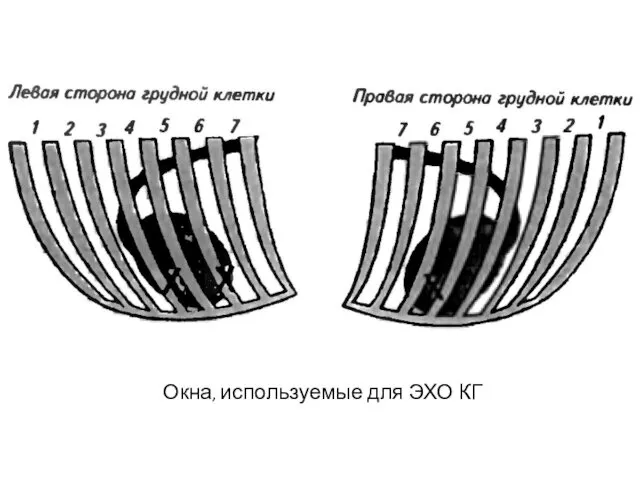 Окна, используемые для ЭХО КГ