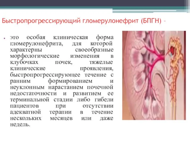 Быстропрогрессирующий гломерулонефрит (БПГН) – это особая клиническая форма гломерулонефрита, для которой