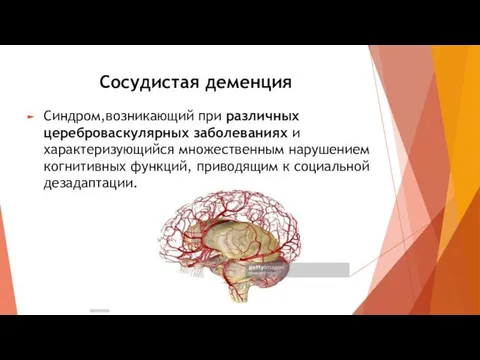 Сосудистая деменция Синдром,возникающий при различных цереброваскулярных заболеваниях и характеризующийся множественным нарушением