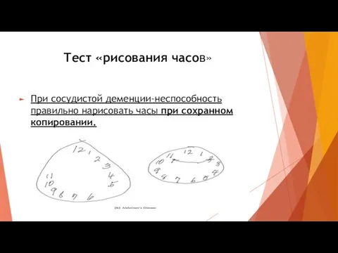 Тест «рисования часов» При сосудистой деменции-неспособность правильно нарисовать часы при сохранном копировании.