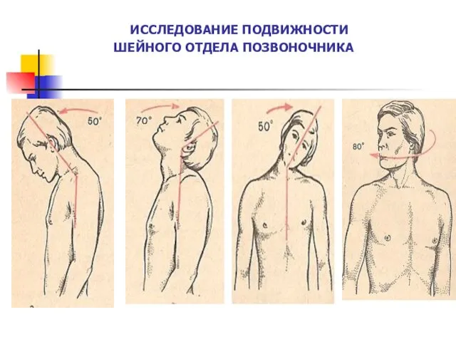 ИССЛЕДОВАНИЕ ПОДВИЖНОСТИ ШЕЙНОГО ОТДЕЛА ПОЗВОНОЧНИКА