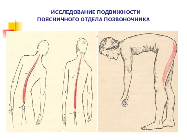 ИССЛЕДОВАНИЕ ПОДВИЖНОСТИ ПОЯСНИЧНОГО ОТДЕЛА ПОЗВОНОЧНИКА