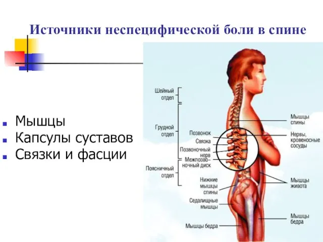 Источники неспецифической боли в спине Мышцы Капсулы суставов Связки и фасции