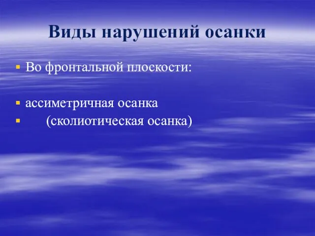 Виды нарушений осанки Во фронтальной плоскости: ассиметричная осанка (сколиотическая осанка)