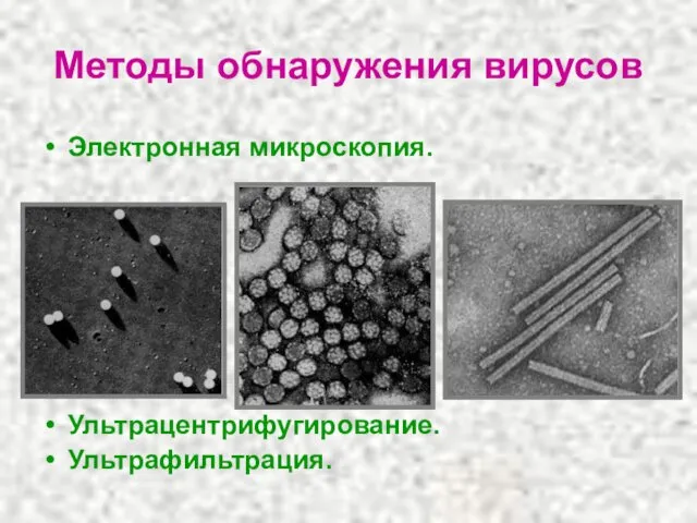 Методы обнаружения вирусов Электронная микроскопия. Ультрацентрифугирование. Ультрафильтрация.