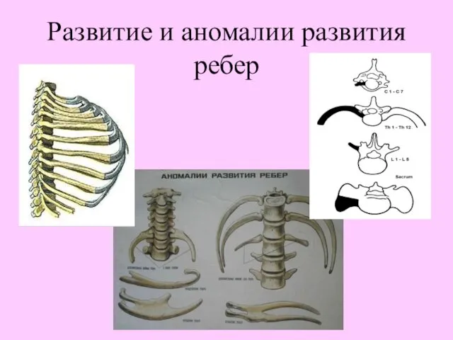 Развитие и аномалии развития ребер