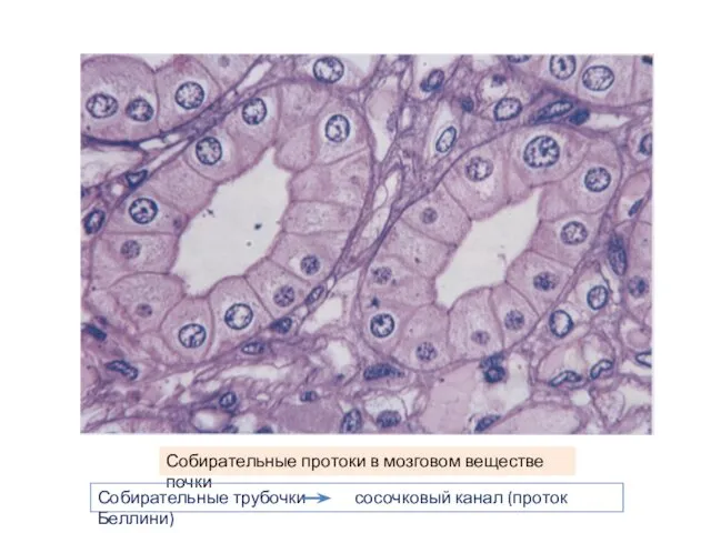 Собирательные трубочки сосочковый канал (проток Беллини)