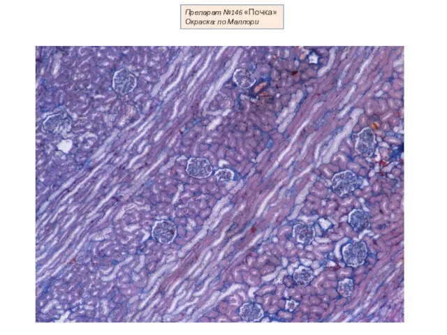 Препарат №146 «Почка» Окраска: по Маллори