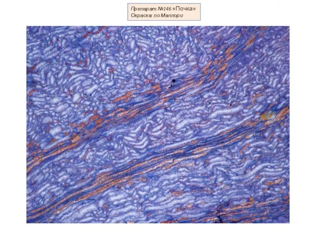 Препарат №146 «Почка» Окраска: по Маллори