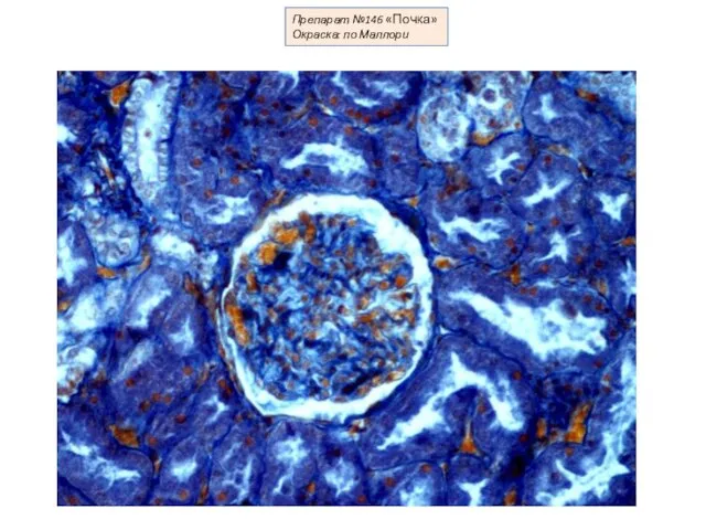 Препарат №146 «Почка» Окраска: по Маллори