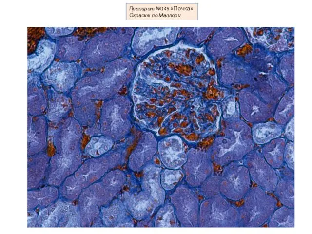 Препарат №146 «Почка» Окраска: по Маллори