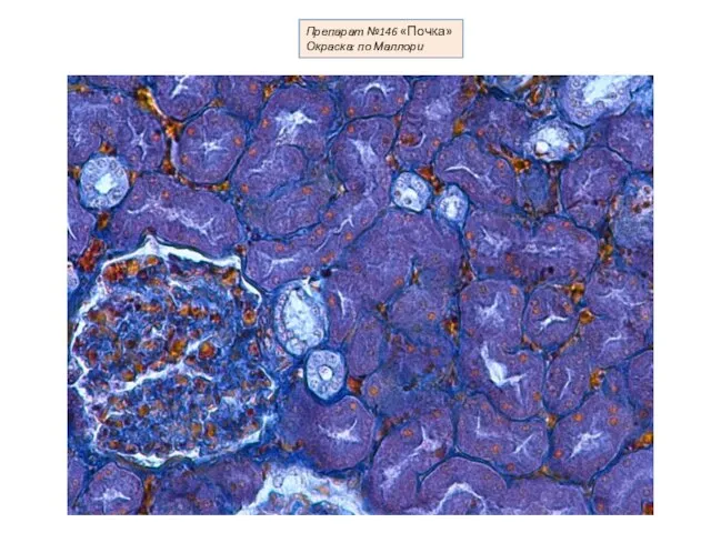 Препарат №146 «Почка» Окраска: по Маллори