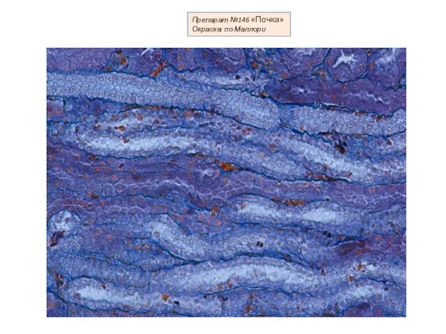 Препарат №146 «Почка» Окраска: по Маллори