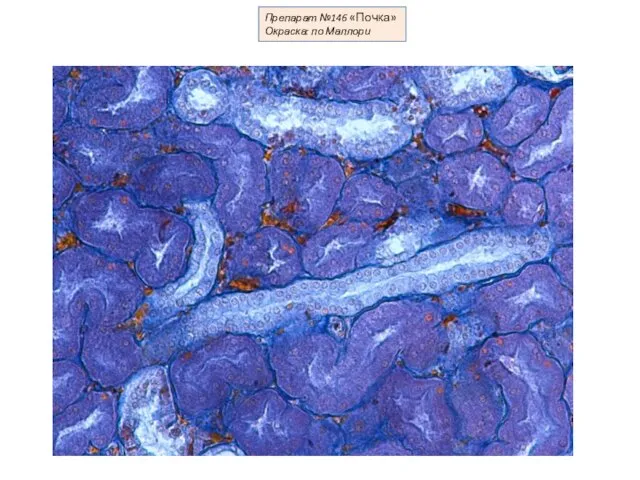 Препарат №146 «Почка» Окраска: по Маллори