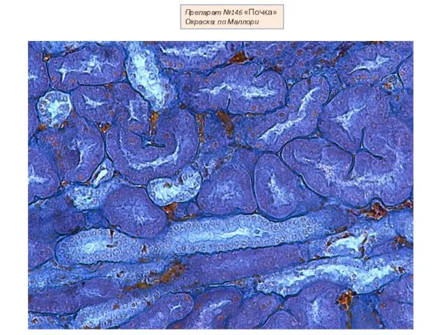 Препарат №146 «Почка» Окраска: по Маллори