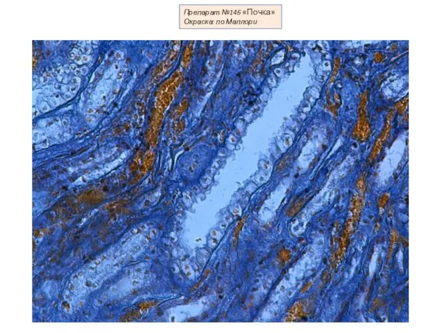 Препарат №146 «Почка» Окраска: по Маллори
