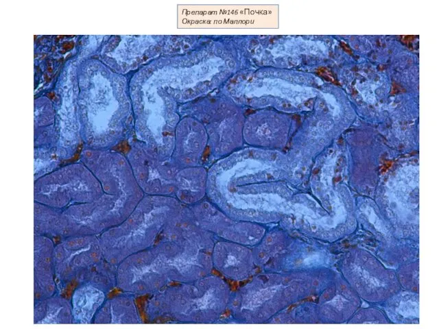 Препарат №146 «Почка» Окраска: по Маллори