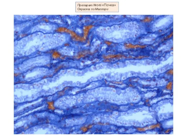 Препарат №146 «Почка» Окраска: по Маллори