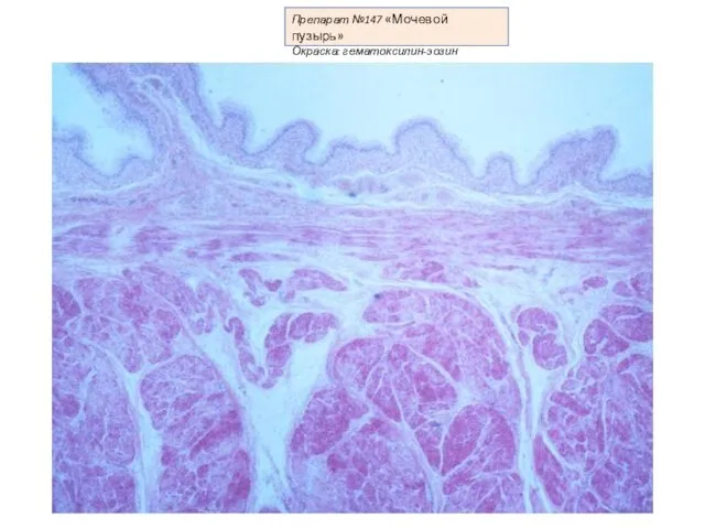 Препарат №147 «Мочевой пузырь» Окраска: гематоксилин-эозин