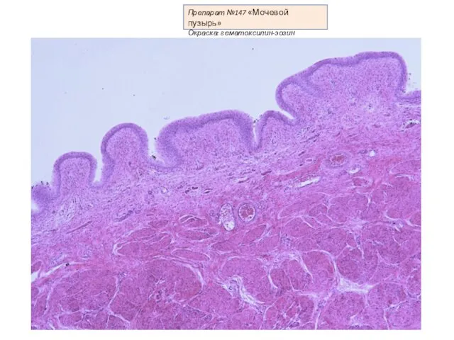 Препарат №147 «Мочевой пузырь» Окраска: гематоксилин-эозин