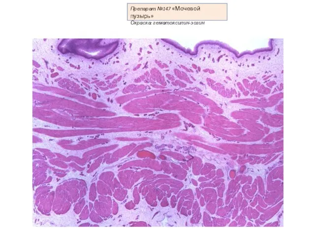 Препарат №147 «Мочевой пузырь» Окраска: гематоксилин-эозин