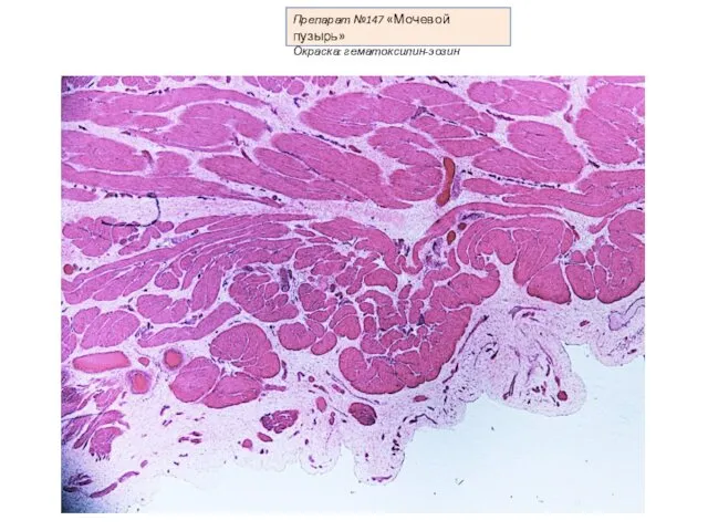 Препарат №147 «Мочевой пузырь» Окраска: гематоксилин-эозин