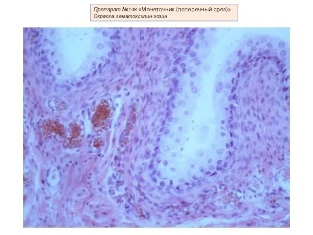 Препарат №148 «Мочеточник (поперечный срез)» Окраска: гематоксилин-эозин